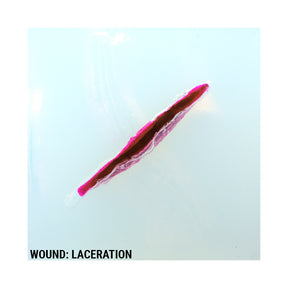 Wound Cube™ 360 - Phokus Research Group
