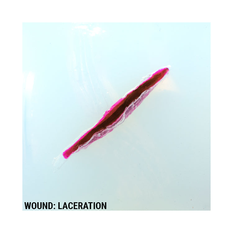 Wound Cube™ 360 - Phokus Research Group