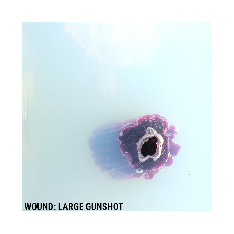 Wound Cube™ 360 - Phokus Research Group
