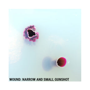 Wound Cube™ 360 - Phokus Research Group